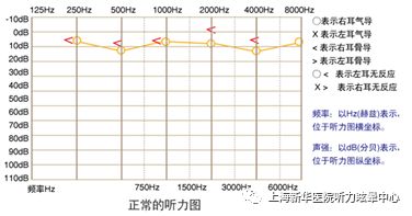 每个人都应该看！戴耳机听歌对耳朵的这些危害，你都了解吗？