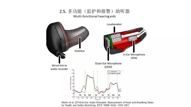 曾凡钢：人工智能&助听器技术前瞻性预测