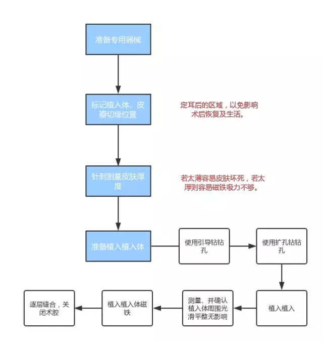 夏寅：骨锚式听觉植入技术（BAHA）